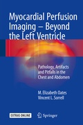 Cover: Myocardial Perfusion Imaging - Beyond the Left Ventricle - Springer