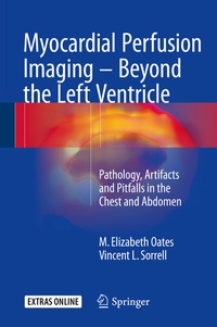 Abbildung von: Myocardial Perfusion Imaging - Beyond the Left Ventricle - Springer