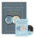 Cover: Minimally Invasive Spine Fusion - Quality Medical Publishing Inc
