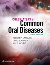 Abbildung von: Color Atlas of Common Oral Diseases - Jones and Bartlett Publishers, Inc