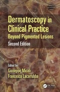 Cover: Dermatoscopy in Clinical Practice - CRC Press