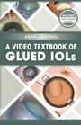 Cover: A Video Textbook of Glued IOLs - SLACK Incorporated