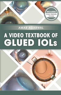 Enlarge image Cover: A Video Textbook of Glued IOLs - SLACK Incorporated
