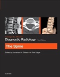 Cover: Grainger & Allison's Diagnostic Radiology: The Spine - Elsevier