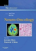 Cover: Neuro-Oncology: Volume 36 - Saunders