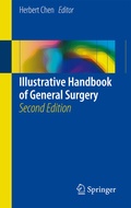 Abbildung von: Illustrative Handbook of General Surgery - Springer