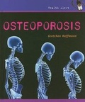Cover: Osteoporosis - Cavendish Square Publishing