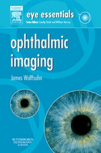 Enlarge image Cover: Eye Essentials: Ophthalmic Imaging - Butterworth-Heinemann