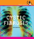 Cover: Cystic Fibrosis - Cavendish Square Publishing
