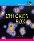 Cover: Chicken Pox - Cavendish Square Publishing