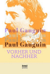 Abbildung von: Vorher und nachher: Lebenserinnerungen - SEVERUS Verlag