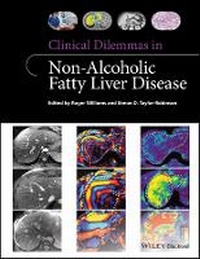 Bild vergrößern Bild: Clinical Dilemmas in Non-Alcoholic Fatty Liver Disease - Wiley