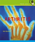 Cover: Arthritis - Cavendish Square Publishing