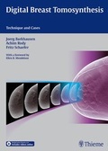 Cover: Digital Breast Tomosynthesis - Thieme