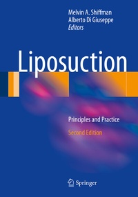 Enlarge image Cover: Liposuction - Springer