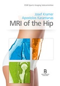 Cover: MRI of the Hip - Breitenseher Publisher