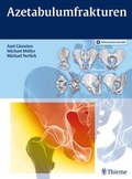 Cover: Azetabulumfrakturen - Thieme