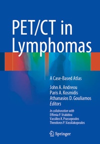Bild vergrößern Bild: PET/CT in Lymphomas - Springer