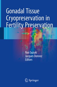 Abbildung von: Gonadal Tissue Cryopreservation in Fertility Preservation - Springer