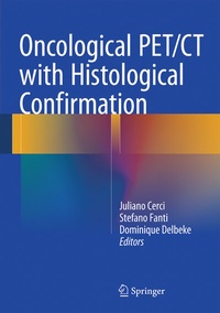 Abbildung von: Oncological PET/CT with Histological Confirmation - Springer