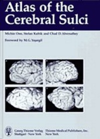 Abbildung von: Atlas of the Cerebral Sulci - Thieme