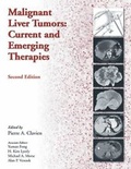 Cover: Malignant Liver Tumors: Current and Emerging Therapies - Jones and Bartlett Publishers, Inc