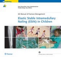 Abbildung von: Elastic Stable Intramedullary Nailing (ESIN) in Children - Thieme