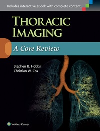 Enlarge image Cover: Thoracic Imaging: A Core Review - Lippincott Williams and Wilkins
