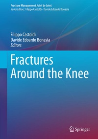 Abbildung von: Fractures Around the Knee - Springer