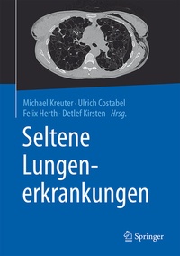 Abbildung von: Seltene Lungenerkrankungen - Springer