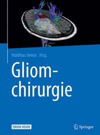 Abbildung von: Gliomchirurgie - Springer
