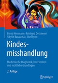 Cover: Kindesmisshandlung - Springer