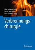 Cover: Verbrennungschirurgie - Springer