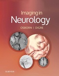 Bild: Imaging in Neurology E-Book - Elsevier