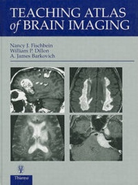 Enlarge image Cover: Teaching Atlas of Brain Imaging - Thieme Publishers