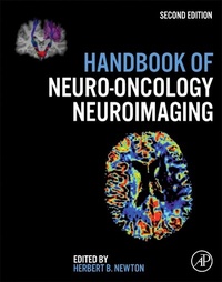 Abbildung von: Handbook of Neuro-Oncology Neuroimaging - Academic Press