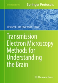 Abbildung von: Transmission Electron Microscopy Methods for Understanding the Brain - Humana Press Inc.
