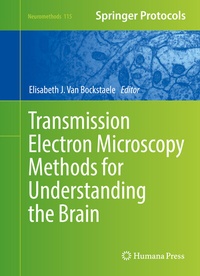 Abbildung von: Transmission Electron Microscopy Methods for Understanding the Brain - Humana
