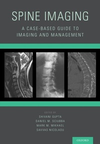Abbildung von: Spine Imaging - OUP eBook
