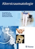 Cover: Alterstraumatologie - Thieme
