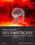 Bild: Video Atlas of Neurosurgery E-Book - Elsevier