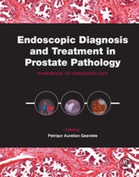 Abbildung von: Endoscopic Diagnosis and Treatment in Prostate Pathology - Academic Press