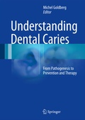 Cover: Understanding Dental Caries - Springer