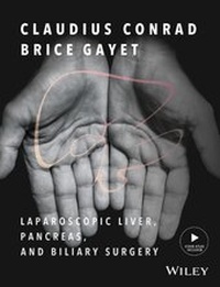 Abbildung von: Laparoscopic Liver, Pancreas, and Biliary Surgery - Wiley-Blackwell
