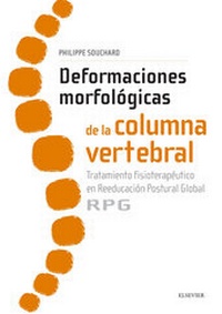 Abbildung von: Deformaciones morfológicas de la columna vertebral - Elsevier