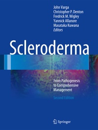 Enlarge image Cover: Scleroderma - Springer