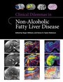 Bild: Clinical Dilemmas in Non-Alcoholic Fatty Liver Disease - Wiley-Blackwell