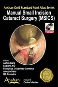 Cover: Mini Atlas of Manual Small Incision Cataract Surgery - Anshan Ltd