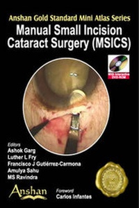 Enlarge image Cover: Mini Atlas of Manual Small Incision Cataract Surgery - Anshan Ltd