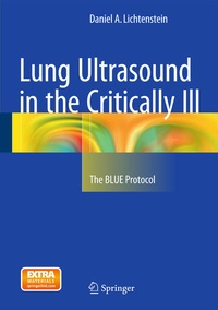 Abbildung von: Lung Ultrasound in the Critically Ill - Springer